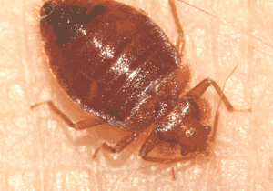 A bed bug is sitting on the surface of a person 's skin.
